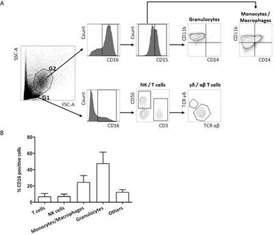 High-Density of FcγRIIIA+ (CD16+) Tumor-Associated Neutrophils in Metastases Improves the Therapeutic Response of Cetuximab in Metastatic Colorectal Cancer Patients, Independently of the HLA-E/CD94-NKG2A Axis